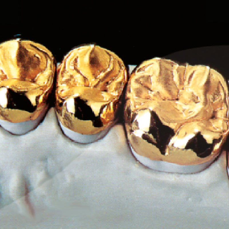 Zahngold